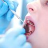 Bố mẹ nên hình thành cho trẻ thói quen vệ sinh răng miệng từ sớm