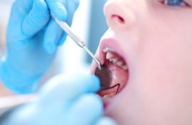 Bố mẹ nên hình thành cho trẻ thói quen vệ sinh răng miệng từ sớm